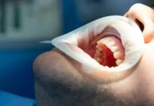 Артур Тумашевич объясняет, почему выпадает коронка и как этого избежать artur tumashevich obyasnyaet pochemu vypadaet koronka i kak etogo izbezhat-stanural-ru-0