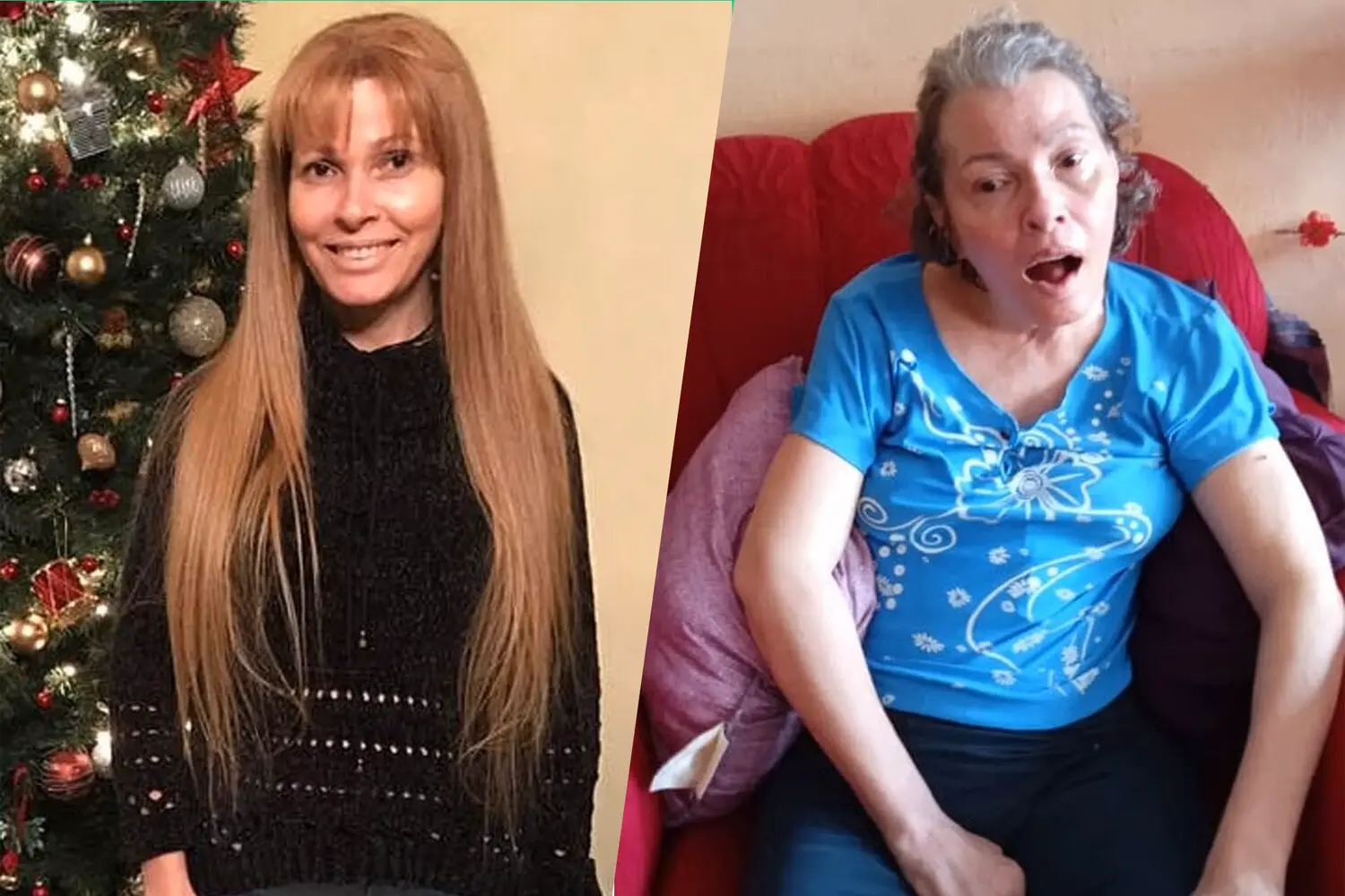 Дайдис Пена Гарсес надеется на восстановление после операции Фермин Моралес-0