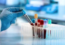 Исследования Лундского университета открывают новые способы борьбы с лейкозом используя SLAMF6 и CRISPR/Cas9 issledovaniya lundskogo universiteta otkryvayut novye sposoby borby s lejkozom ispolzuya 6 i 9-stanural-ru-0