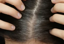 Профессор Нисимура раскрывает секрет баланса между седыми волосами и меланомой professor nisimura raskryvaet sekret balansa mezhdu sedymi volosami i melanomoj-stanural-ru-0