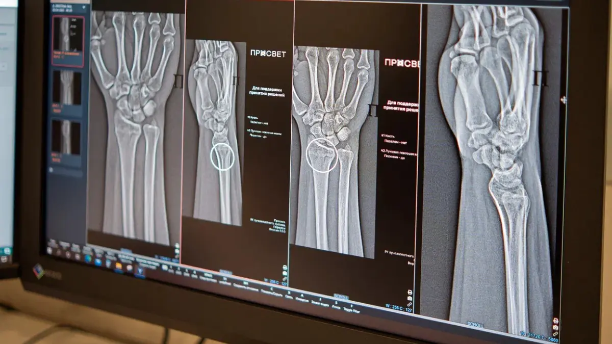 Заммэра Ракова: Теперь нейросети помогают московским рентгенологам по 43 клиническим направлениям