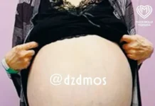 v moskve uspeshno udalili gigantskuyu opuhol yaichnika u paczientki-stanural-ru-0