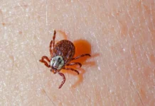 Владислав Жемчугов считает, что анализ клеща победит энцефалит vladislav zhemchugov schitaet chto analiz kleshha pobedit enczefalit-stanural-ru-0