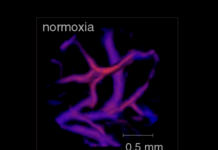 innovaczii v optoakusticheskoj tomografii na baze ot rossijskogo nauchnogo fonda-missionary-su-175247830800-0