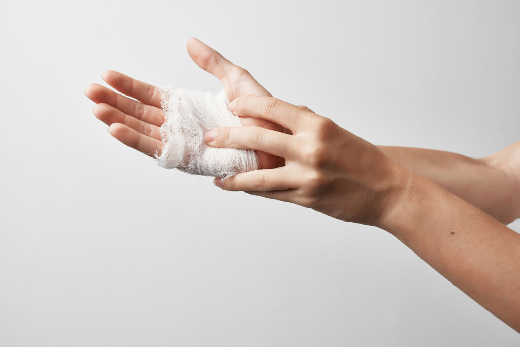 Перевязанная рука