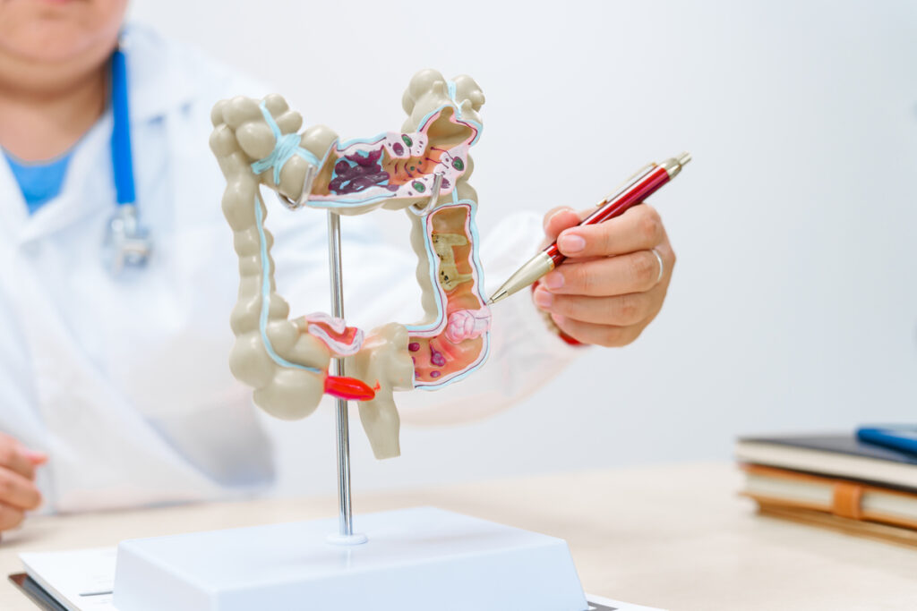 Врач держит модель анатомии толстой кишки человека