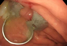 Детский научно-клинический центр имени Л.М. Рошаля спас школьницу detskij nauchnoklinicheskij czentr imeni lm roshalya spas shkolniczu-gazetart-ru-0