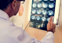 Курчатовский институт создал молекулу для адресной терапии глиобластомы kurchatovskij institut sozdal molekulu dlya adresnoj terapii glioblastomy-gazetart-ru-0