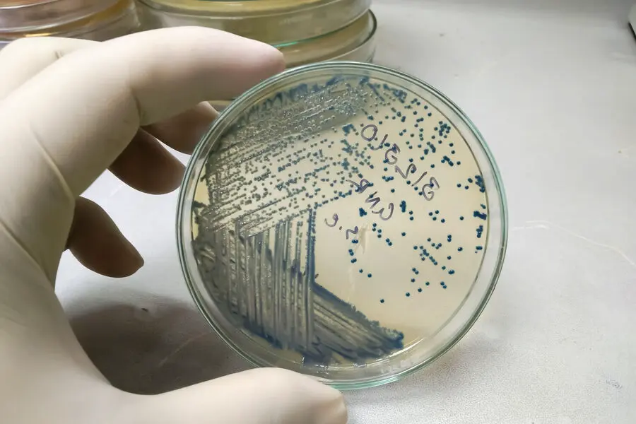Университет Нагоя усилил синтез белков Escherichia coli с ИИ-0