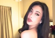 Альма Версо из Дубая делится историей ринопластики в Иране в TikTok alma verso iz dubaya delitsya istoriej rinoplastiki v irane v -gazetart-ru-0