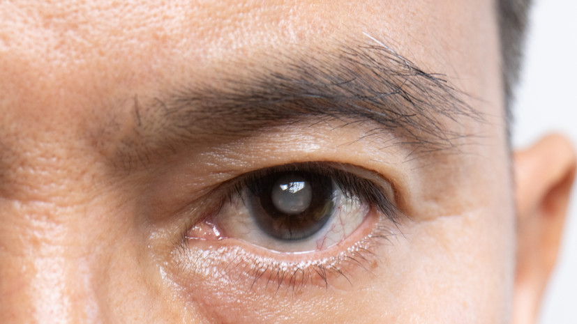 Современная медицина успешно справляется с катарактой 20c312d9-d689-4167-8060-86bb6ac68a13-67d98efe