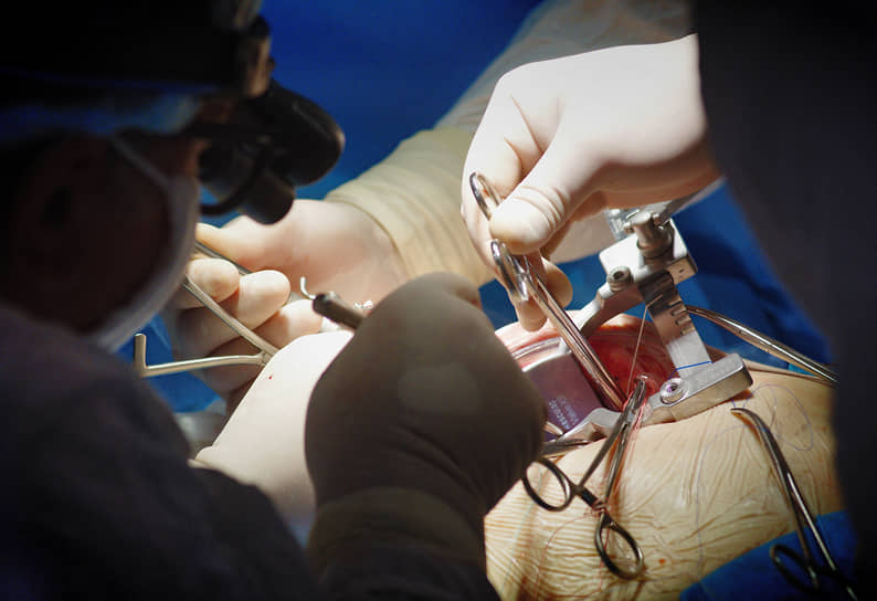 Революционный прорыв в трансплантологии 559f670d-6665-4ca9-a6ae-a5c8714f7387-67e98163