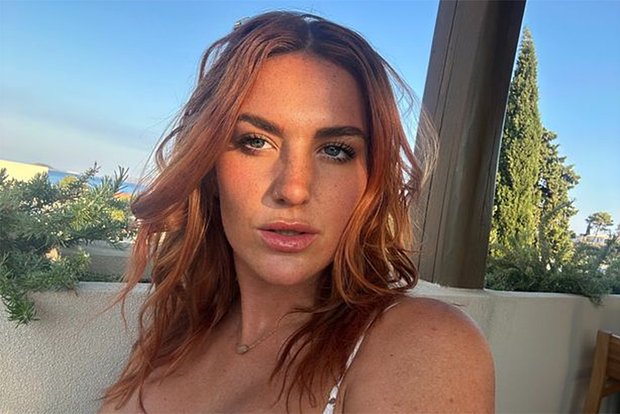 Модель с уникальной особенностью делится успехами в работе с поклонниками db3b35fe-af1a-468b-bcf1-ad79205bd4b4-67d93ff6