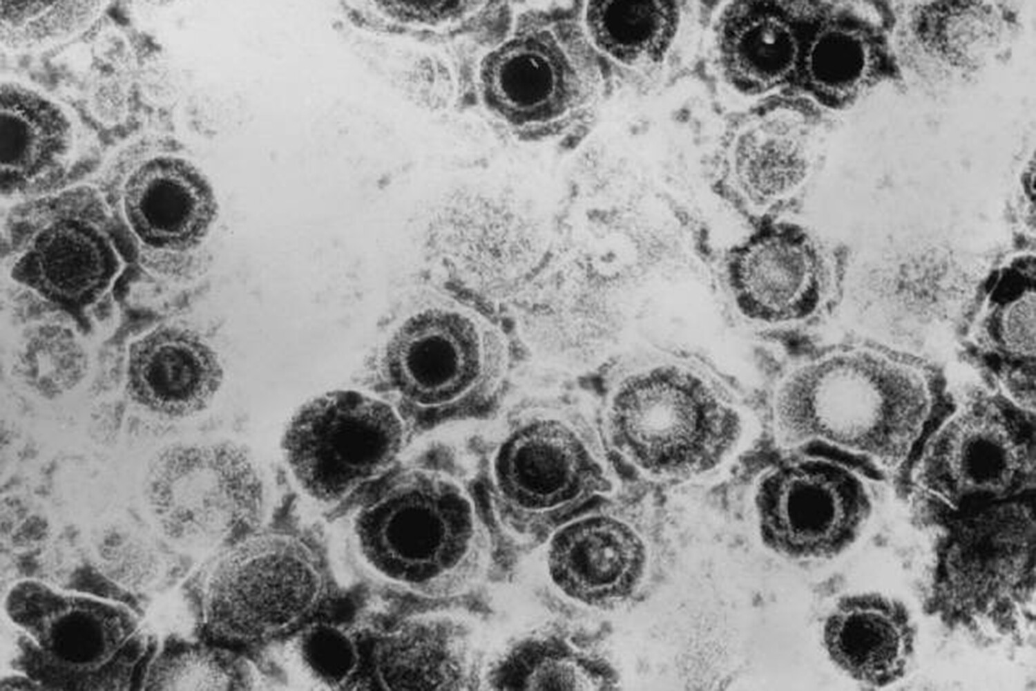 Прорыв в изучении герпеса открывает новые пути лечения proryv v izuchenii gerpesa otkryvaet novye puti lecheniya-dmvv-ru-174095762200-0