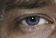 Советы офтальмолога Динары Лоовой из клиники 3Z по защите глаз весной от травм sovety oftalmologa dinary loovoj iz kliniki 3 po zashhite glaz vesnoj ot travm-dmvv-ru-174296763500-0