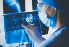 Инновации Р-Фарм и Ларисы Смирновой в лечении меланомы и рака легкого innovaczii rfarm i larisy smirnovoj v lechenii melanomy i raka legkogo-dmvv-ru-174551268800-0