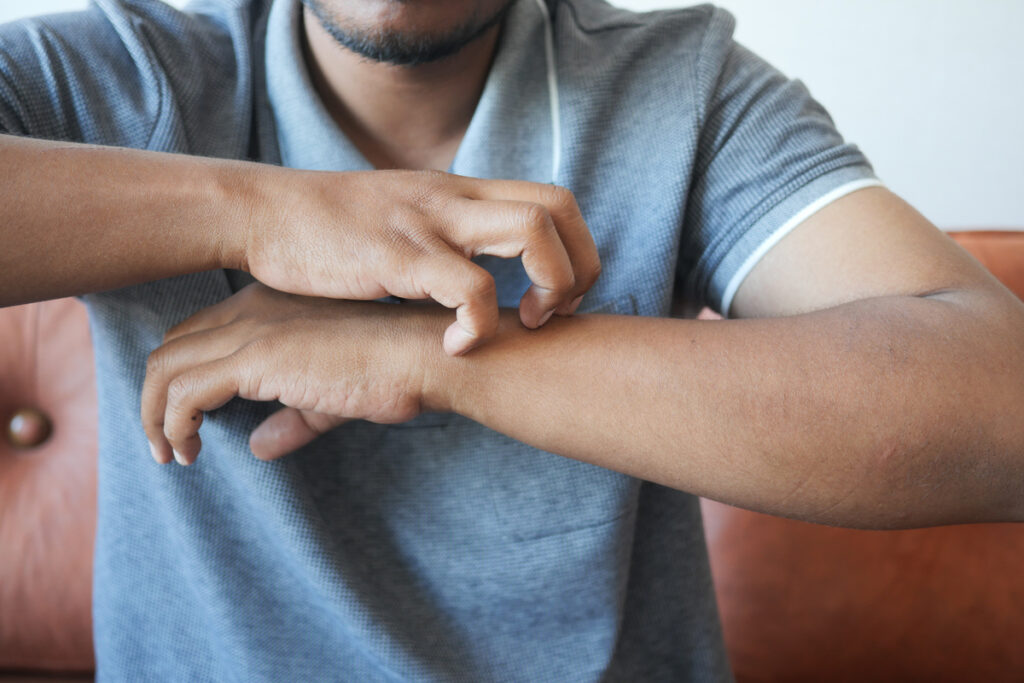 мужчина чешет руку крупным планом