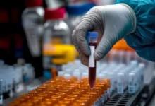 Камера КТС-УОМЗ от «Швабе» Ростех делает прорыв в хранении крови kamera ktsuomz ot shvabe rosteh delaet proryv v hranenii krovi-dmvv-ru-174833260100-0