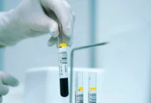 Данные Ohasama Study открывают путь к продлению жизни через контроль уровня глюкозы! dannye otkryvayut put k prodleniyu zhizni cherez kontrol urovnya glyukozy-dmvv-ru-0