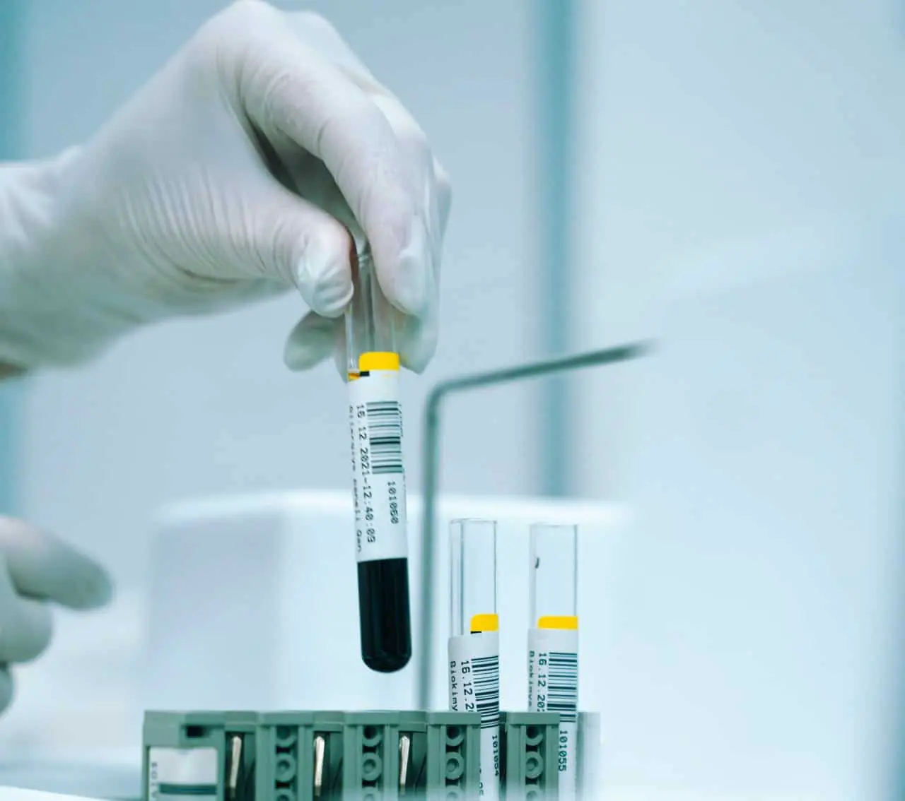 Данные Ohasama Study открывают путь к продлению жизни через контроль уровня глюкозы!-0