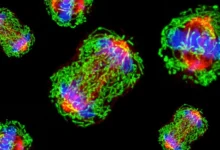 ekzosomy i insulinorezistentnost uskoryayut razvitie trizhdy negativnogo raka grudi-dmvv-ru-0