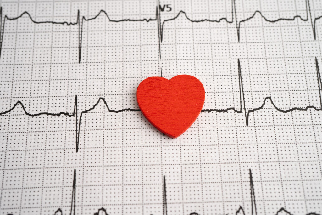 красное сердце на электрокардиограмме