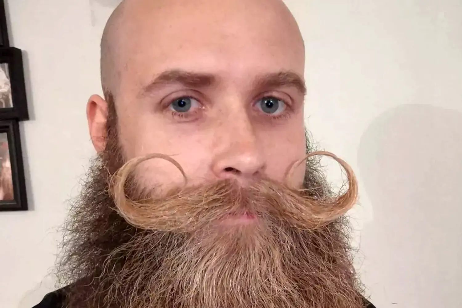 Льюис Эйлмер одержал победу на чемпионате мира по бороде после травли в школе-0