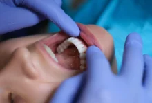 vyacheslav gluhov i klinika lyuchidus o roste populyarnosti domashnih plomb-dmvv-ru-0