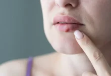 Елена Волчкова объясняет, как стресс и холод воздействуют на иммунитет elena volchkova obyasnyaet kak stress i holod vozdejstvuyut na immunitet-dmvv-ru-0