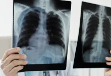 Доктора Владислав Жемчугов и Сергей Авдеев дают советы по ОРВИ и пневмонии doktora vladislav zhemchugov i sergej avdeev dayut sovety po orvi i pnevmonii-dmvv-ru-0