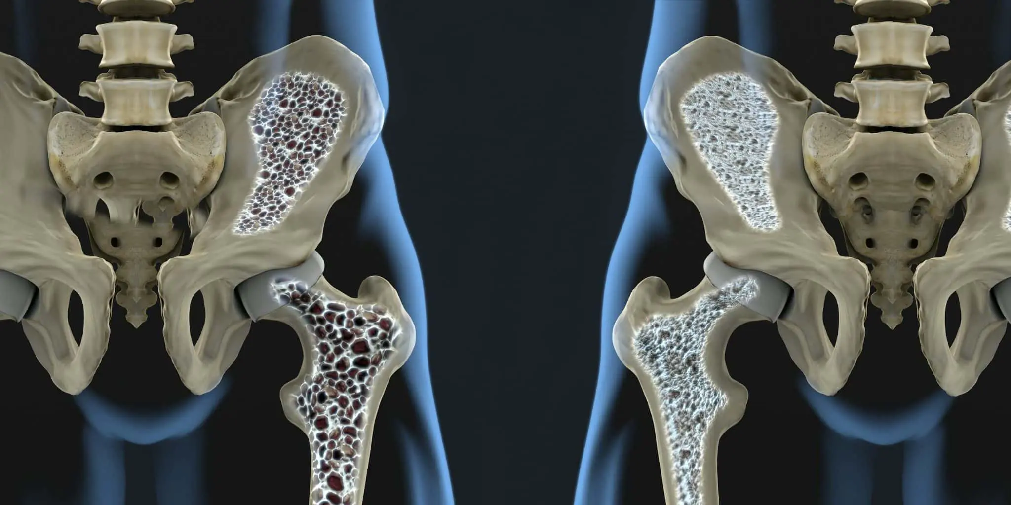 Новый подход в борьбе с остеопорозом предложила Инес Либшер из Лейпцигского университета-0