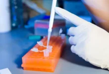 СПбПУ разработал наночастицы для лучшей терапии меланомы и метастазов spbpu razrabotal nanochasticzy dlya luchshej terapii melanomy i metastazov-dmvv-ru-0