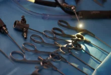 В Красногорске следственный комитет расследует взрыв, в результате которого ребенок сохранил мизинец после операции v krasnogorske sledstvennyj komitet rassleduet vzryv v rezultate kotorogo rebenok sohranil mizinecz posle operaczii-dmvv-ru-0