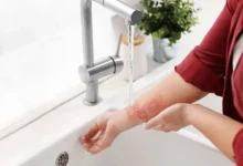 Александр Калюжин из Государственного университета просвещения рассказал о причинах долгого заживления ран aleksandr kalyuzhin iz gosudarstvennogo universiteta prosveshheniya rasskazal o prichinah dolgogo zazhivleniya ran-dmvv-ru-0