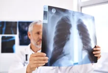 Личинки Spirometra mansoni были обнаружены у любительницы лягушек в Шанхае lichinki byli obnaruzheny u lyubitelniczy lyagushek v shanhae-dmvv-ru-0