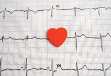 Гусева из Пироговского: ранний признак сердечных болезней guseva iz pirogovskogo rannij priznak serdechnyh boleznej-dmvv-ru-0
