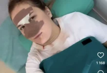 Гульназ Камалетдинова из Уфы неудачно перенесла ринопластику gulnaz kamaletdinova iz ufy neudachno perenesla rinoplastiku-dmvv-ru-0