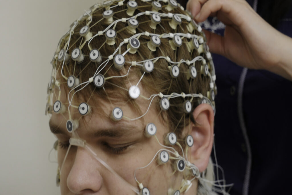 Электростимуляция мозга