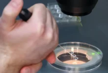 ekoklinika prolyuteks opyt obrashheniya paczientki v novomed-dmvv-ru-0