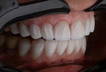 sekret legkogo kontrolya vesa chto vazhno znat o zdorove zubov-gazetarf-ru-174047745000-0  gazetarf