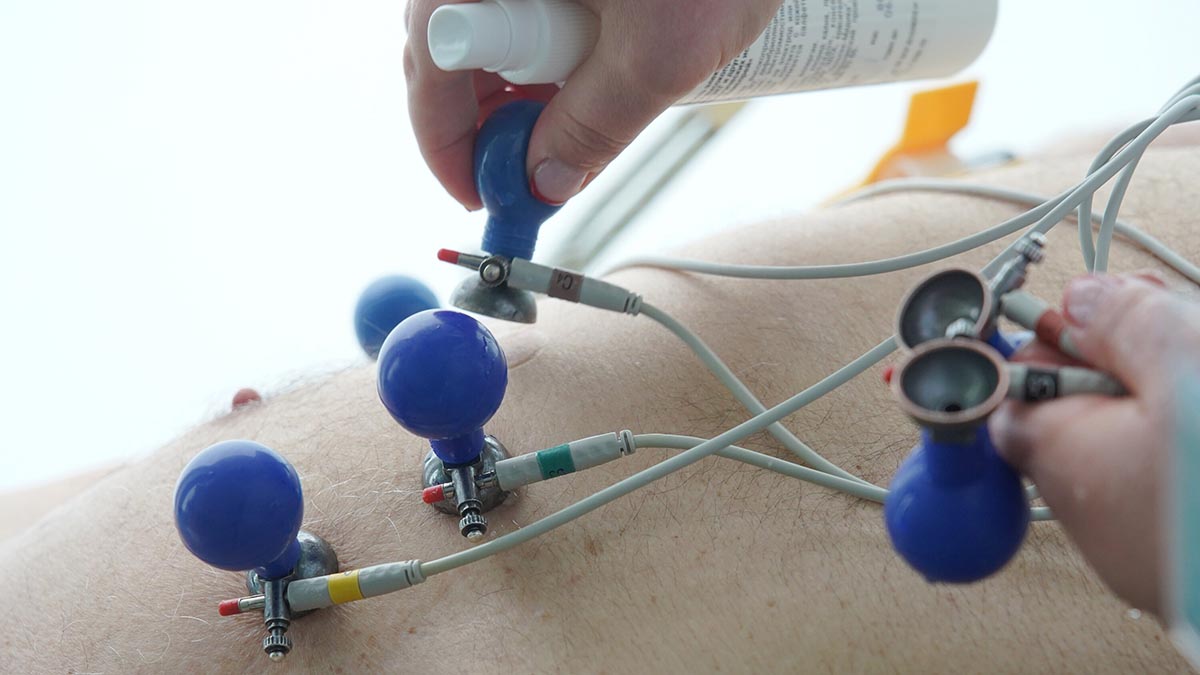 «Яблоко» в сердце: опухоль такого размера удалили кардиохирурги Сеченовского Университета.