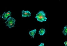 issledovanie immunnyh kletok i metabolizma lipidov s ispolzovaniem -gazetarf-ru-0