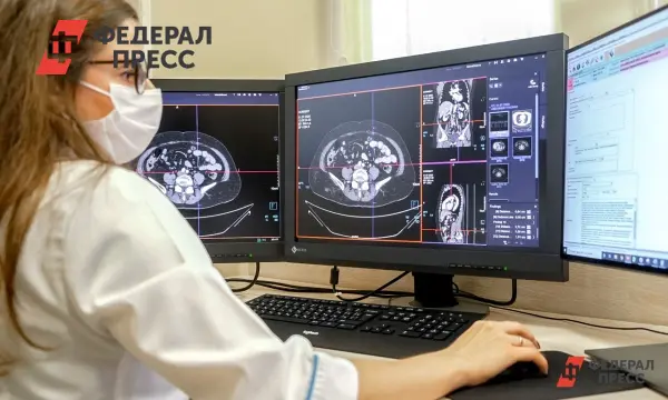 Ученые Лобагородского университета разработали ИИ для диагностики глиом мозга-0