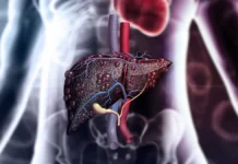 Надежда Чернышова и Кирилл Салиев обсуждают причины цирроза в России nadezhda chernyshova i kirill saliev obsuzhdayut prichiny czirroza v rossii-gazetarf-ru-0