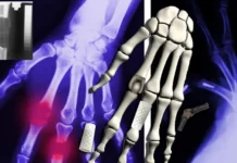 Создание биоразлагаемых костных имплантатов с помощью Томского политеха и Минобрнауки sozdanie biorazlagaemyh kostnyh implantatov s pomoshhyu tomskogo politeha i minobrnauki-gazetarf-ru-0