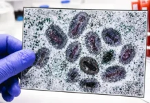 Домодедовская больница и Роспотребнадзор оптимистичны в борьбе с оспой domodedovskaya bolnicza i rospotrebnadzor optimistichny v borbe s ospoj-gazetarf-ru-0