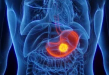 Ольга Тарасова о выводах Пироговского университета о гастрите и раке olga tarasova o vyvodah pirogovskogo universiteta o gastrite i rake-gazetarf-ru-0