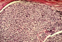 Сеченовский Университет с Юрием Ефремовым исследует раковые клетки sechenovskij universitet s yuriem efremovym issleduet rakovye kletki-gazetarf-ru-0