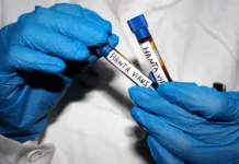 hantavirus andes ne obnaruzhen rospotrebnadzorom v evrope i azii-gazetarf-ru-0