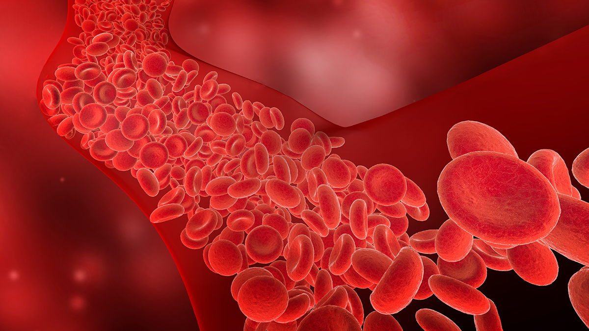 Врач Лапа объяснила, как бороться с тромбообразованием